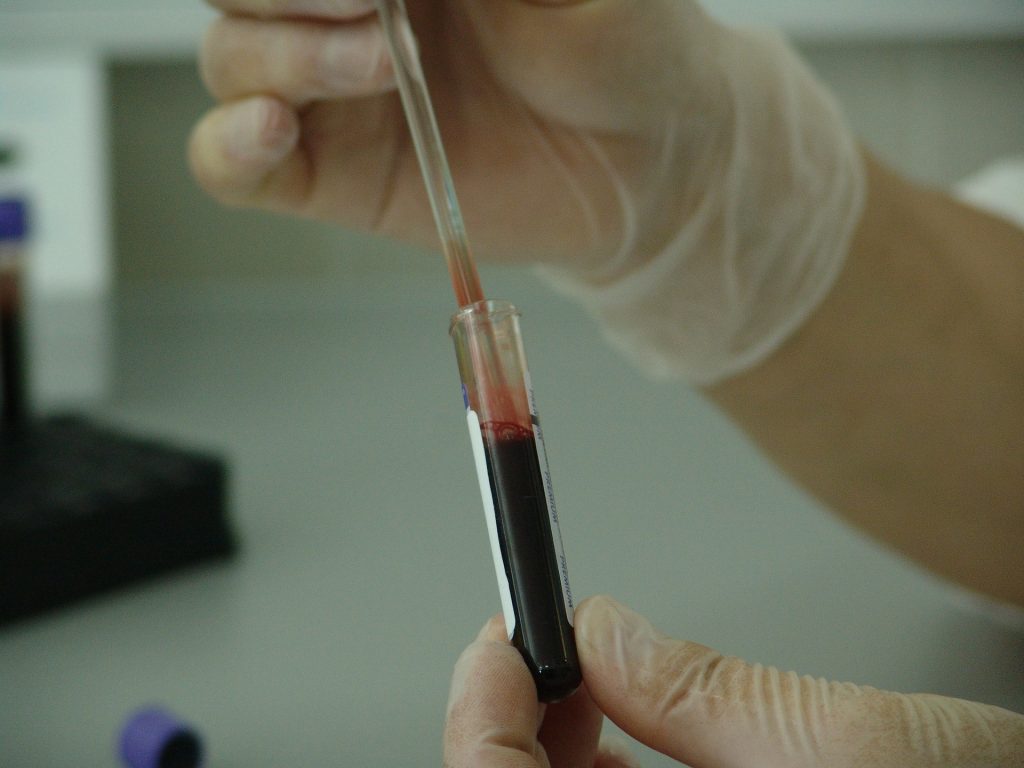 Blood Test, STD testing