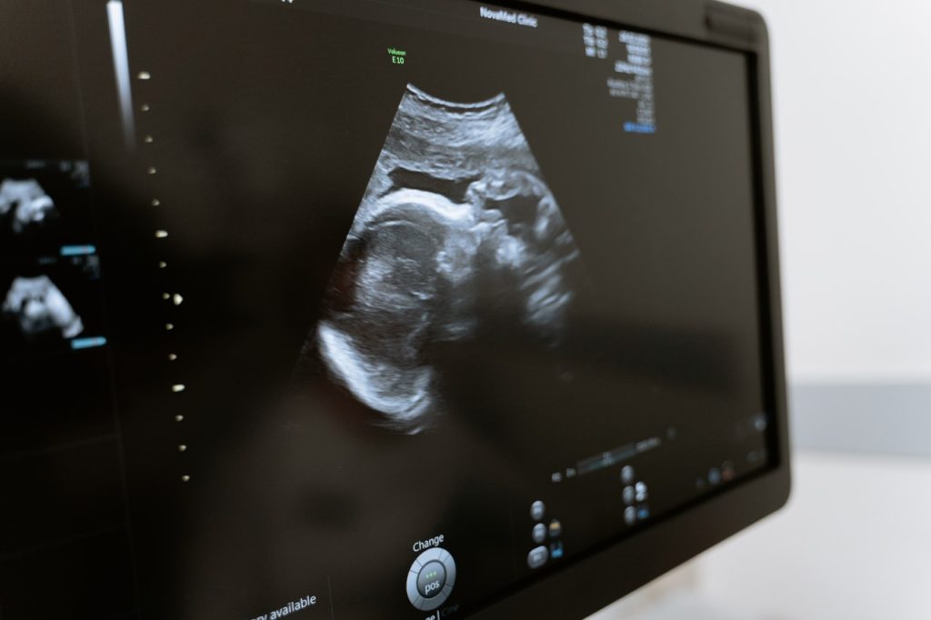 free limited pregnancy ultrasound